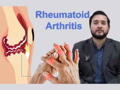 Rheumatoid Arthritis Awareness By Dr. Rohil Amir Babar