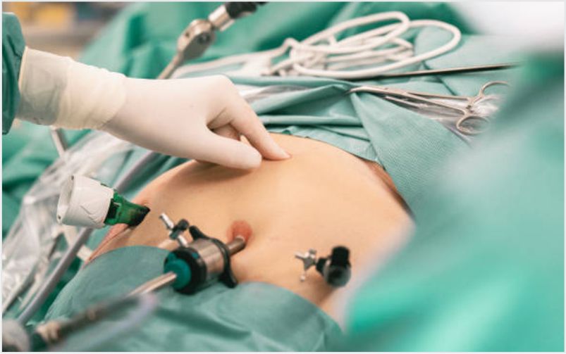 Bariatric Surgery
