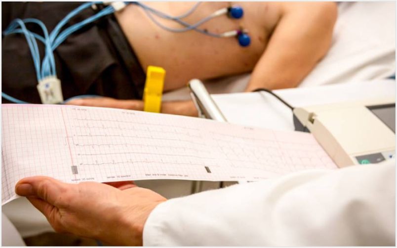Electrocardiogram